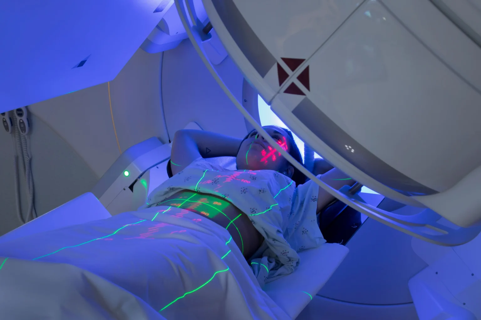 Radiotherapy Benefits Overall Survival