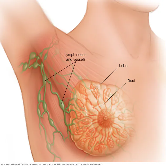 Breast Cancer: A Comprehensive Overview